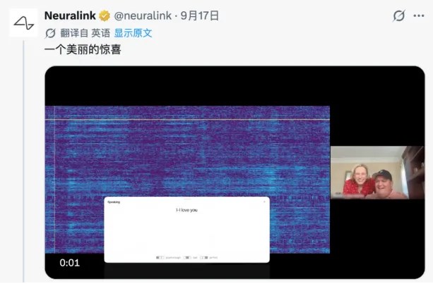 馬斯克腦機介面公司新突破：失語者憑意念“說出”我愛你