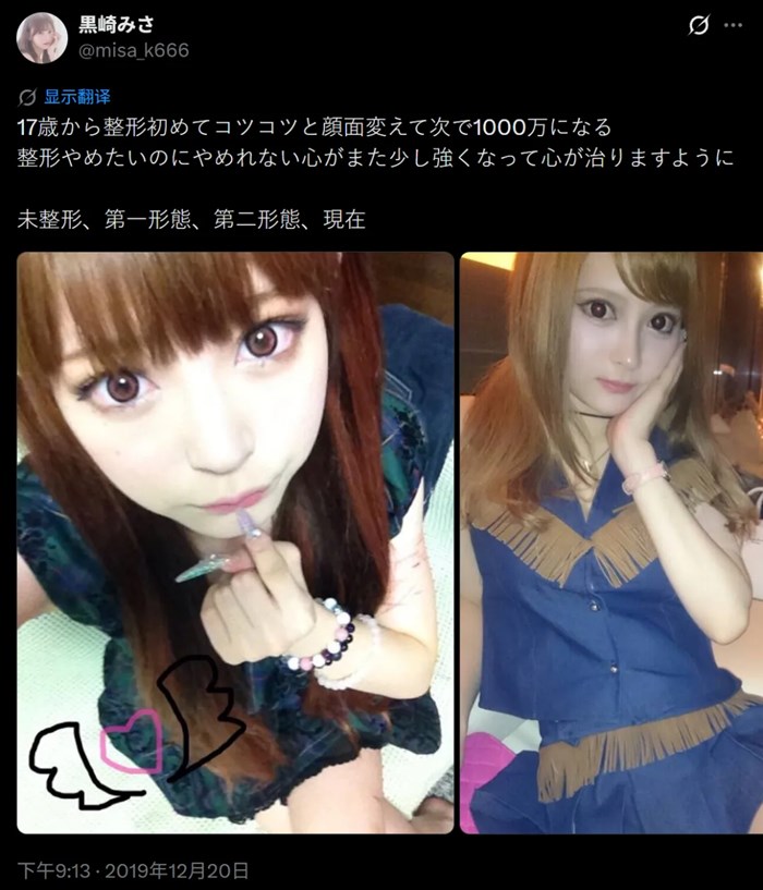 日本小姐姐17歲時沉迷整容！歷時13年，花費2000萬...終於整成原來的模樣？！